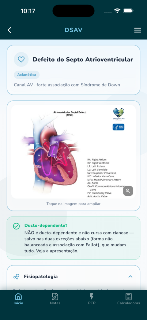 DSAV — defeito do septo atrioventricular com desenho da lesão e conduta